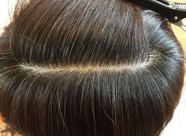 ３０代からの白髪の悩み